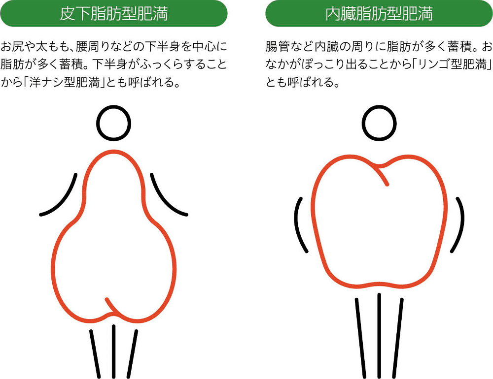 皮下脂肪型肥満：お尻や太もも、腰周りなどの下半身を中心に脂肪が多く蓄積。下半身がふっくらすることから「洋ナシ型肥満」とも呼ばれる。内蔵脂肪型肥満：腸管など内臓の周りに脂肪が多く蓄積。おなかがぽっこり出ることから「リンゴ型肥満」とも呼ばれる。