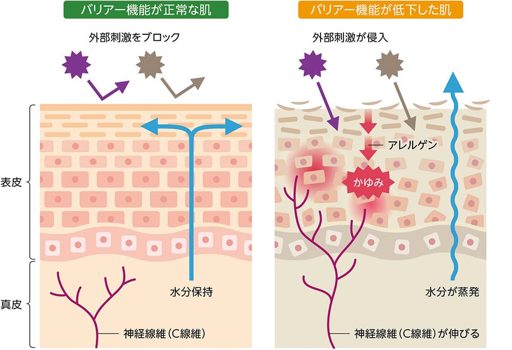 皮膚の断面図が2つ並んだイラスト。左側は「バリア機能が正常な肌」を示し、角質層が整った状態で外部刺激がブロックされ、水分が皮膚内部に保持されている様子が描かれている。右側は「バリア機能が低下した肌」を示し、角質層が乱れている状態で外部刺激が侵入し、アレルゲンと接触することで「かゆみ」が発生。さらに水分が蒸発している様子が描かれている。真皮部分では神経線維（C線維）が肌の表面付近まで伸びており、炎症やかゆみを悪化させる状態を示している。