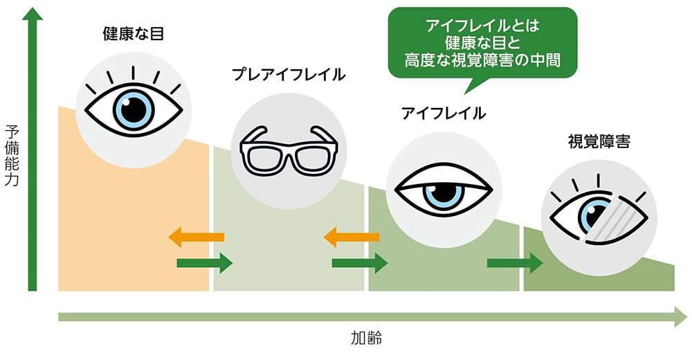 目の健康状態を加齢とともに変化する予備能力として示した図。左から右に進むにつれて、健康な目、プレアイフレイル、アイフレイル、視覚障害の順で状態が悪化する。予備能力は左から右に進むにつれて低下する。アイフレイルは健康な目と高度な視覚障害の中間の状態を指す。